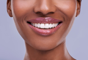 A beautiful smile with a dental implant San Francisco Dental Arts in San Francisco, CA