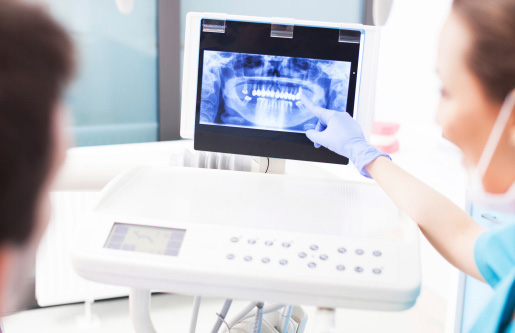 Photograph of dentist showing digital x-ray at San Francisco Dental Arts in San Francisco CA