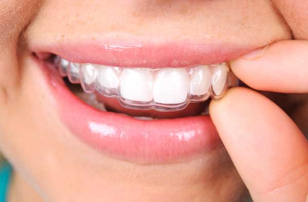Woman using clear aligner