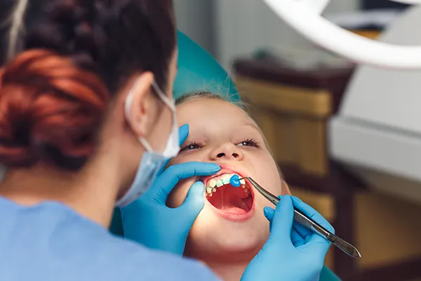 Young boy patiently keeping his mouth open while dental assistant applies fluoride