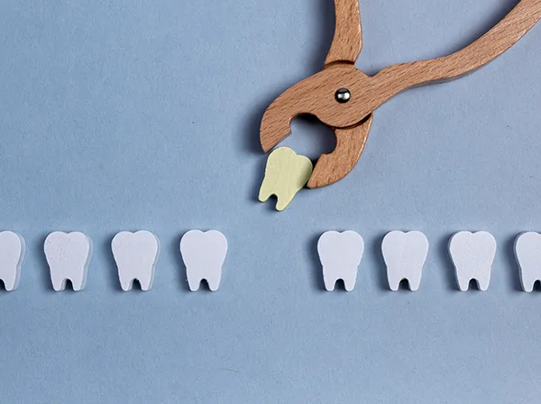 Row of wooden tooth shapes, one of which is being pulled out of the row by dental pliers Row of wooden tooth shapes, one of which is being pulled out of the row by dental pliers