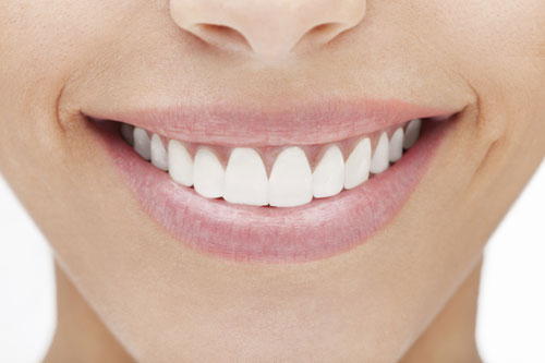 A perfect smile with Porcelain Veneers at San Francisco Dental Arts in San Francisco, CA