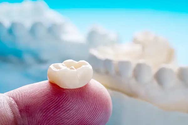 Close-up of a single ceramic dental crown resting on a fingertip at San Francisco Dental Arts in San Francisco, CA